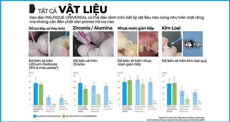 Palfique Universal Bond tương thích với tất cả vật liệu